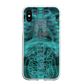 Чехол для iPhone XS Max матовый с принтом рентген человека в Петрозаводске, Силикон | Область печати: задняя сторона чехла, без боковых панелей | кости | органы | рентген | человек