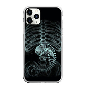 Чехол для iPhone 11 Pro матовый с принтом Чужой на Рентгене в Петрозаводске, Силикон |  | Тематика изображения на принте: alien | больница | больной | внутренний мир | врач | клиника | кости | пациент | ребра | рентген | скелет | снимок | хищник