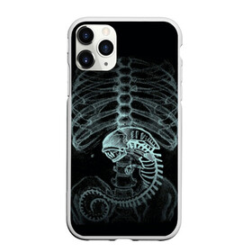 Чехол для iPhone 11 Pro Max матовый с принтом Чужой на Рентгене в Петрозаводске, Силикон |  | alien | больница | больной | внутренний мир | врач | клиника | кости | пациент | ребра | рентген | скелет | снимок | хищник