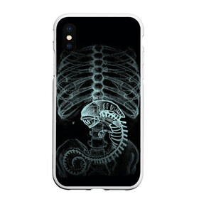 Чехол для iPhone XS Max матовый с принтом Чужой на Рентгене в Петрозаводске, Силикон | Область печати: задняя сторона чехла, без боковых панелей | alien | больница | больной | внутренний мир | врач | клиника | кости | пациент | ребра | рентген | скелет | снимок | хищник