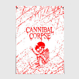 Постер с принтом cannibal corpse в Петрозаводске, 100% бумага
 | бумага, плотность 150 мг. Матовая, но за счет высокого коэффициента гладкости имеет небольшой блеск и дает на свету блики, но в отличии от глянцевой бумаги не покрыта лаком | Тематика изображения на принте: cannibal | cannibal corpse | cannibal corpse butchered at birth | cannibal corpse eaten back to life | cannibal corpse hammer smashed face | corpse | death metal | металл | пластинки с металлическим лезвием | рок | труп каннибала